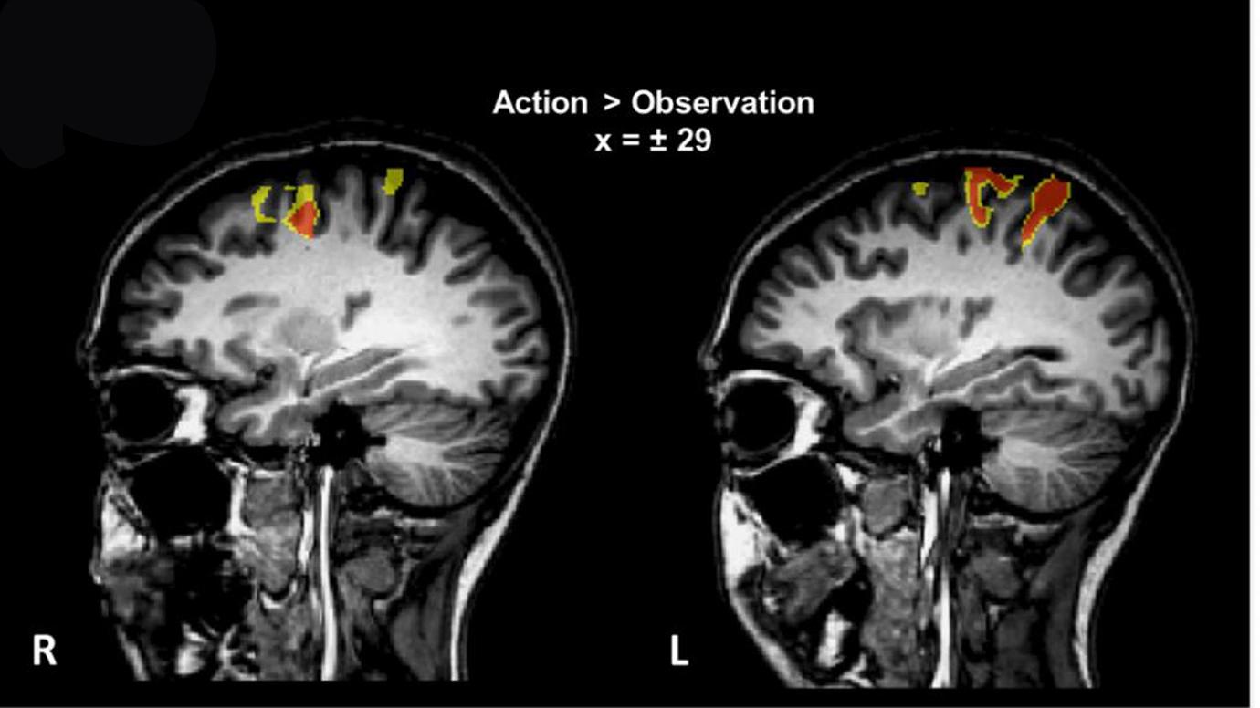 Brain scan showing comparisons between two brains in a learning environment.