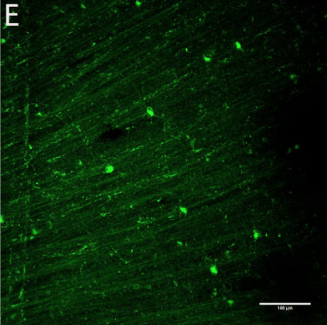 Figure 1-E