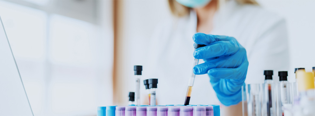 Scientist with laptop placing test tube in tray of test tubes