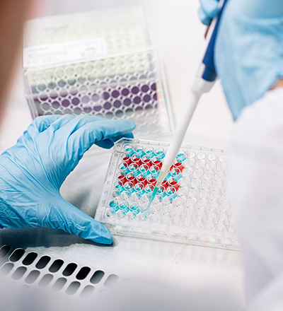 Susan Campbell Laboratory, McCallum Basic Health Sciences Building. Close-up, hands of female student wearing PPE gloves while using a single-channel pipette, November 2024., 