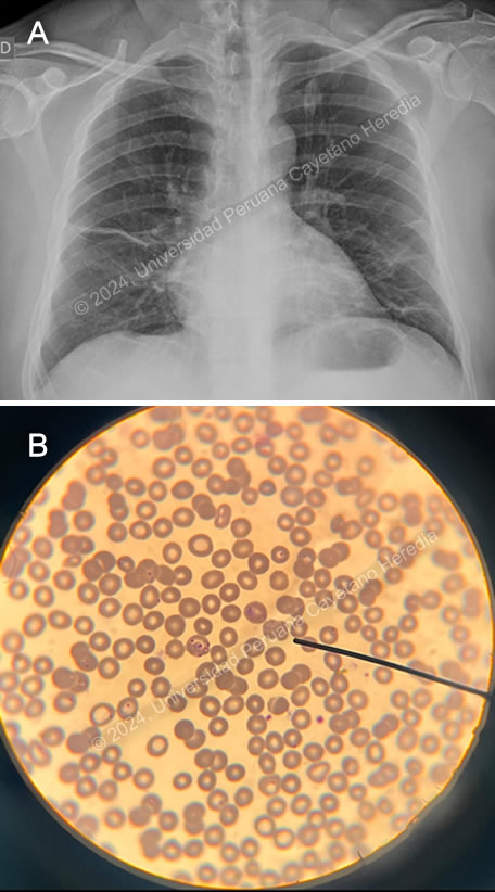 Image for Case 2024-1