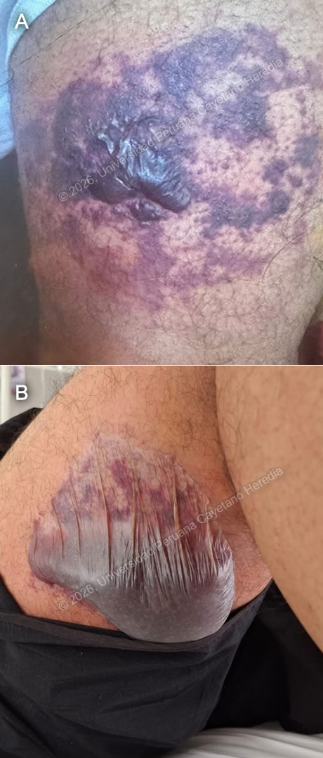 Image for Case 2026-1