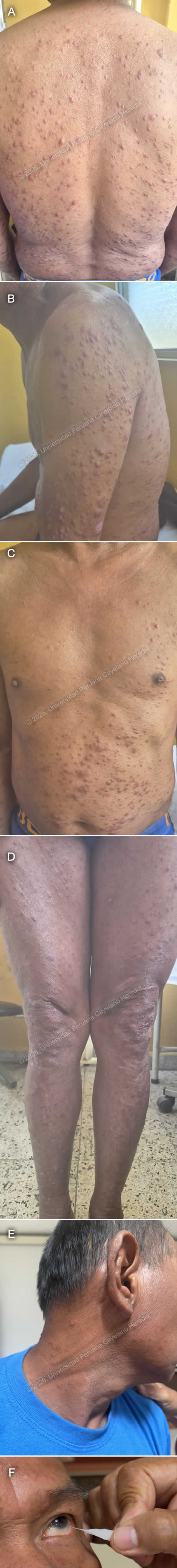 Image for Case 2026-6