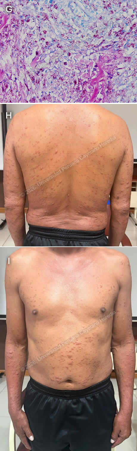 Images for Case 2026-6