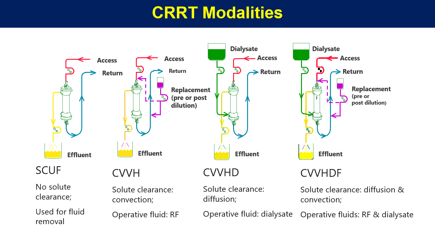 CRRT modalities Tolwani