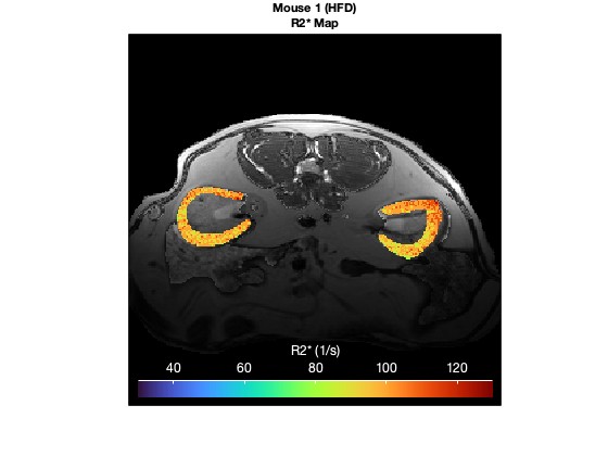 Advanced Study of Renal Physiology
