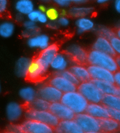 Gastric-gland-cell-death-2