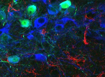 Harms-neurons s