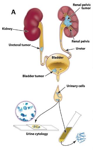 eLife Sciences Pub UroSEEK