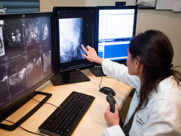 The back of a radiologist pointing to the computer screen with several monitors around her. She has scans up on each monitor and is holding a clicker