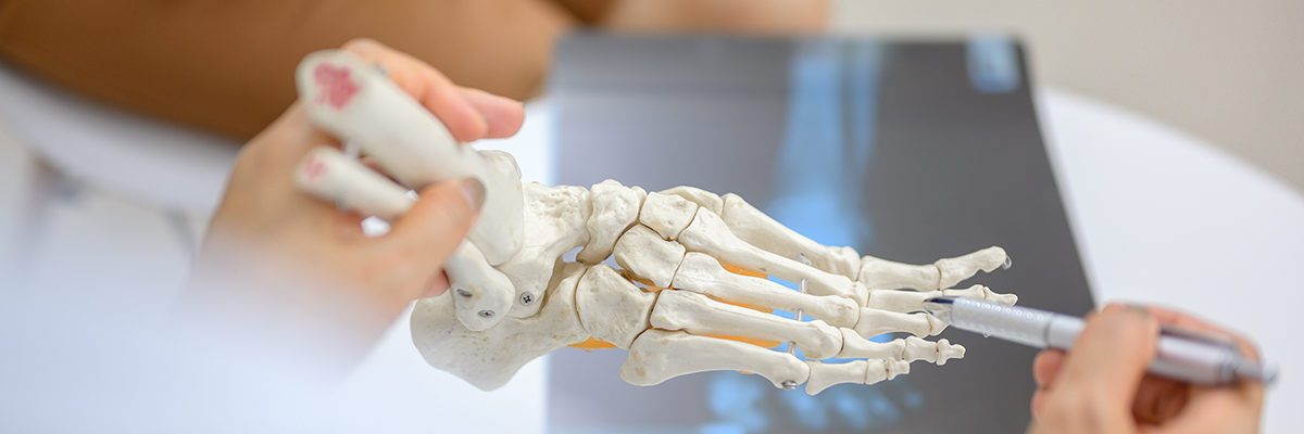 Close-up photo of an orthopedic doctor holding a model of ankle and foot bones explaining to a patient about foot bone problems. Concept of health care for feet and foot bones