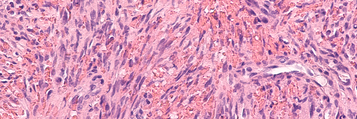 onocolgy clinical banner