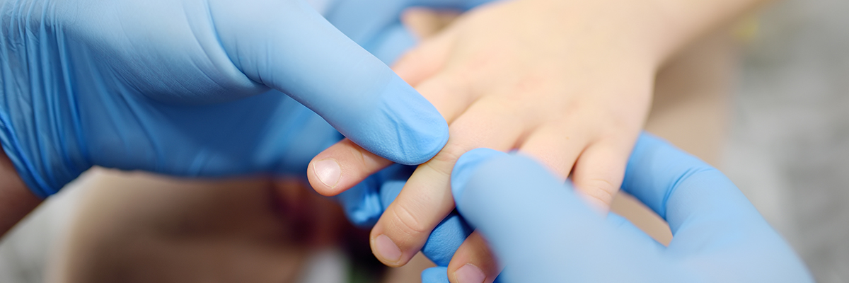 Little boy is at an appointment with a doctor traumatologist with an arm injury. The child pinched or broke a finger. An orthopedic surgeon examines the joints of a small patient. Injuries in children