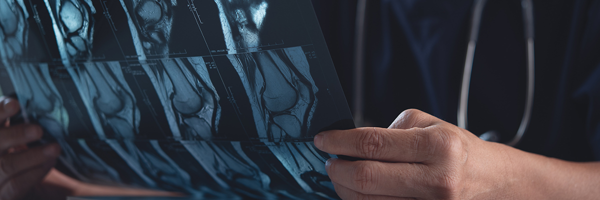 Doctor holding and looking patient bone x-ray film before surgery. MRI and CT scan examining at radiology orthopedic unit in hospital. Knee joint x-ray for treatment