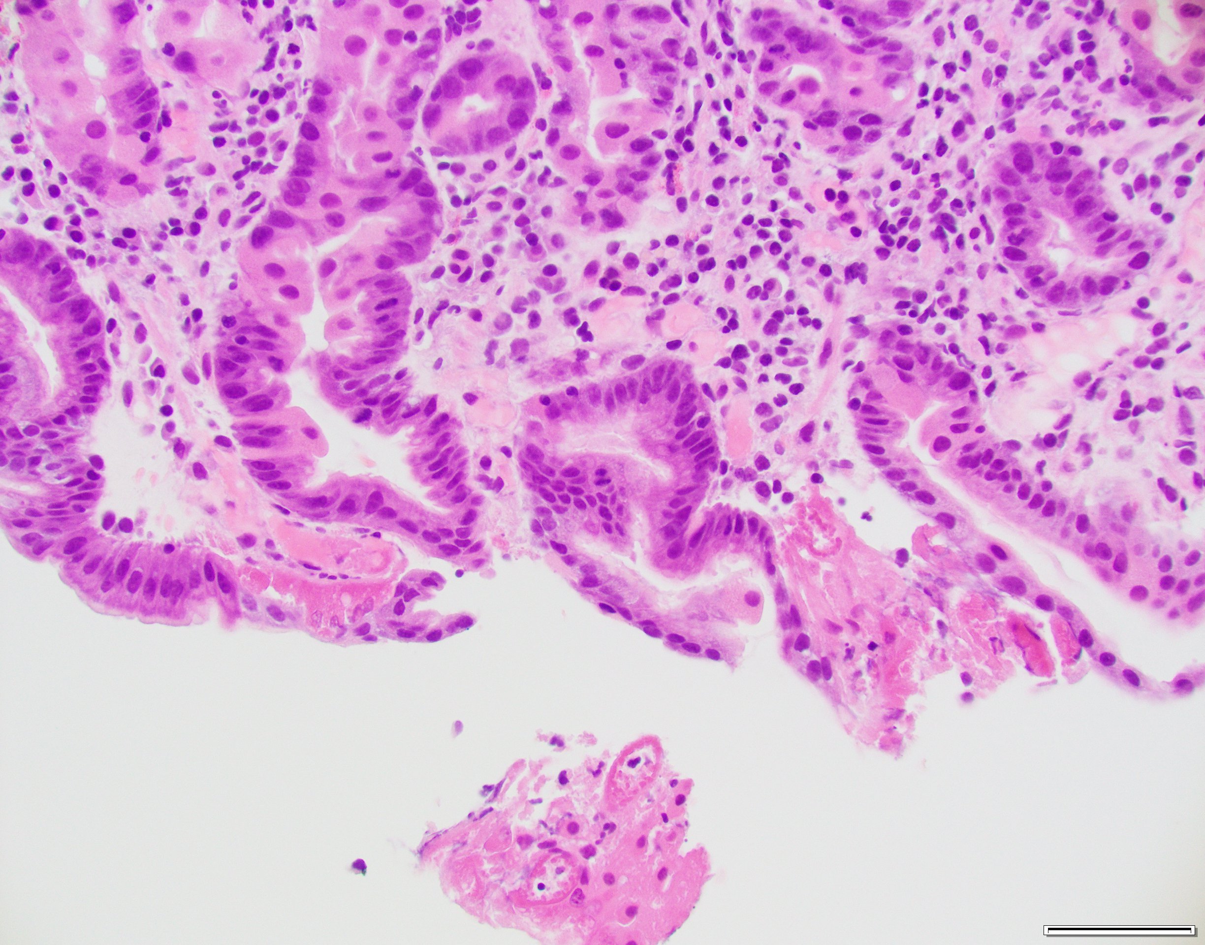 Case of the week gastric biopsy 2