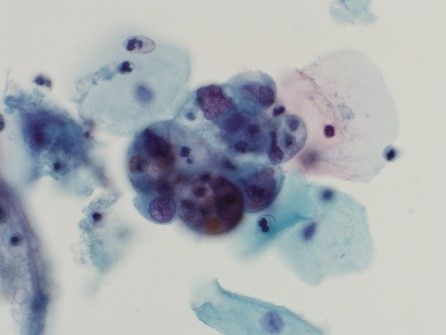 Cytopath_3.jpg