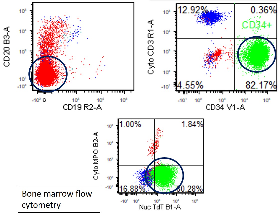 Question Photo 1 Bone marrow flow cytometry