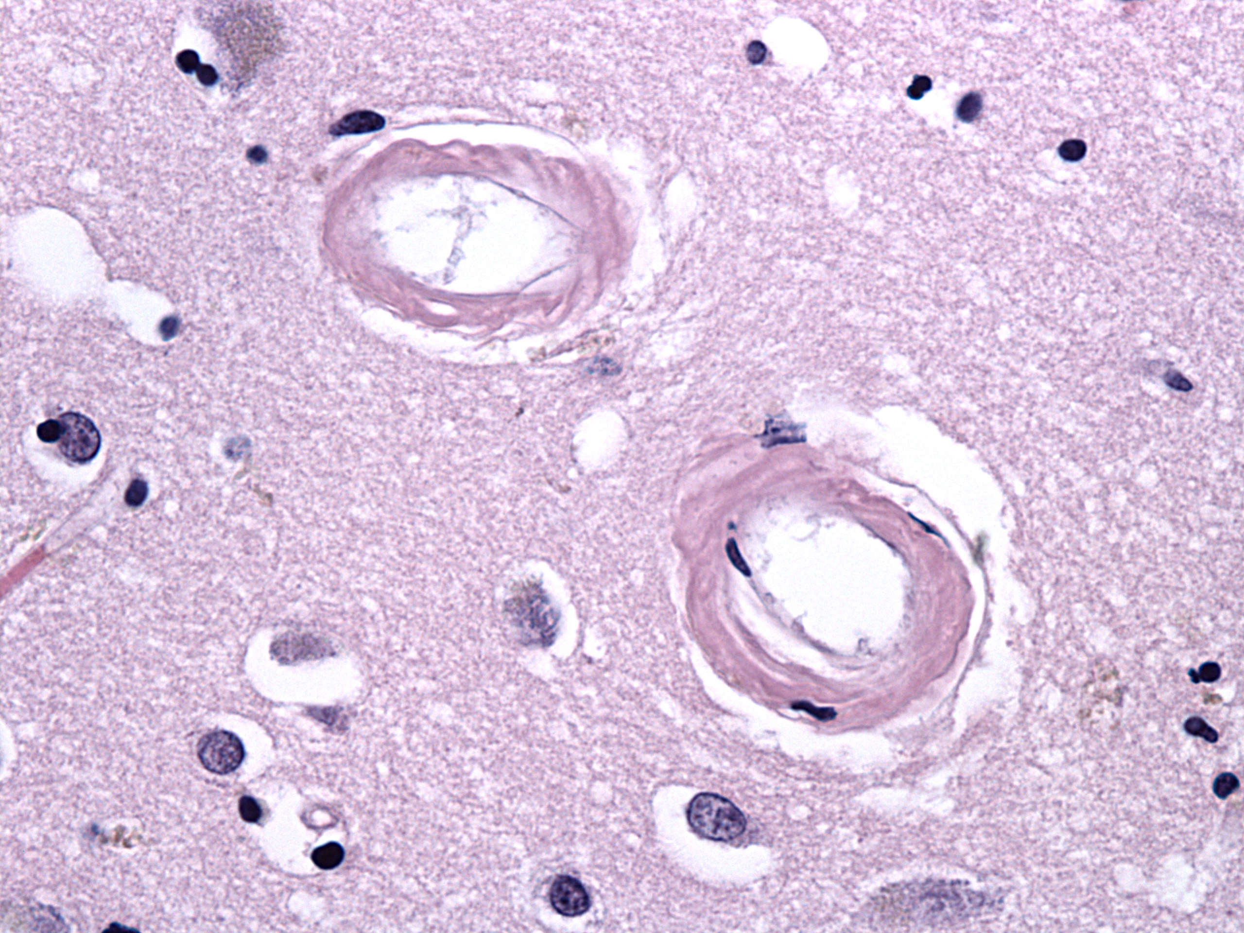 Fig 1 Neocortex