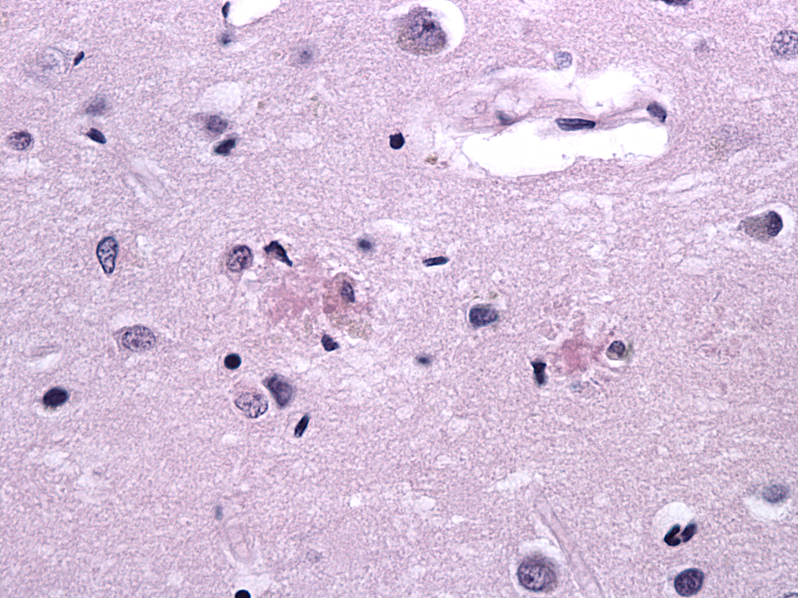 Fig 2 Neocortex