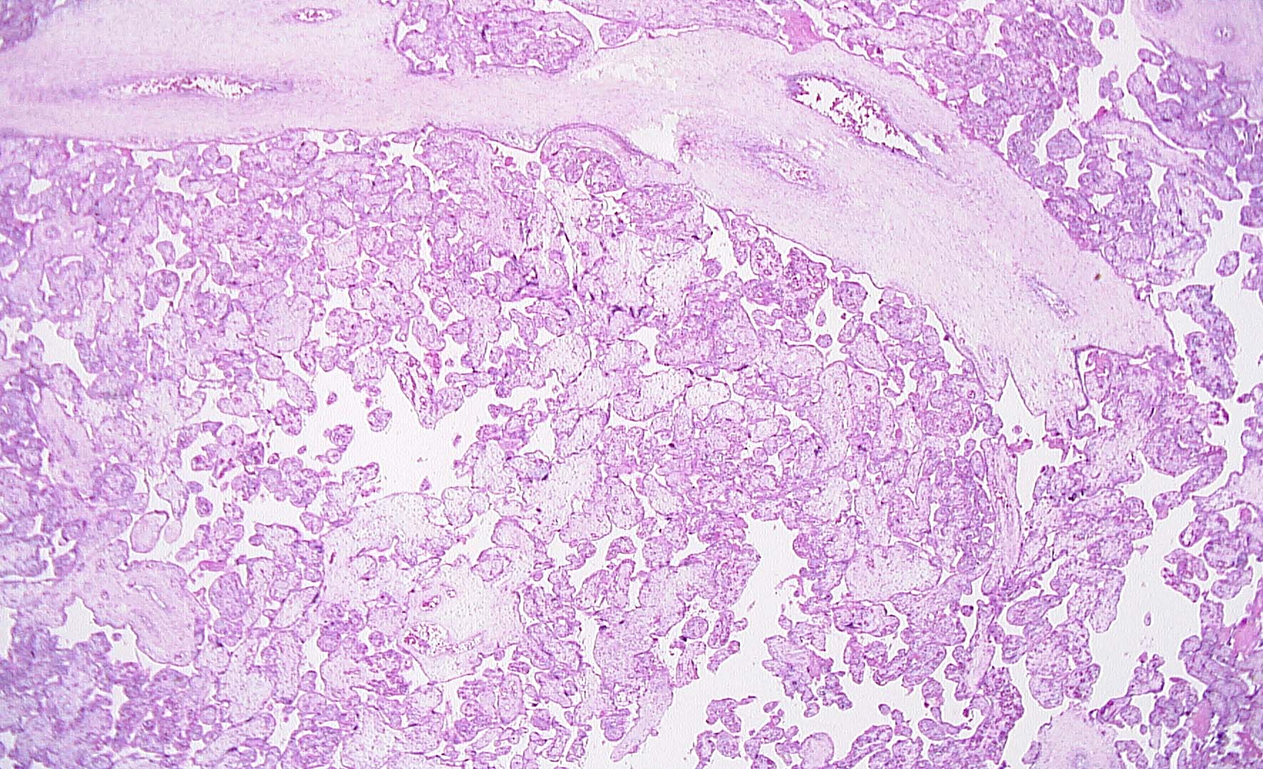 FIG3 4x image with edema NIH