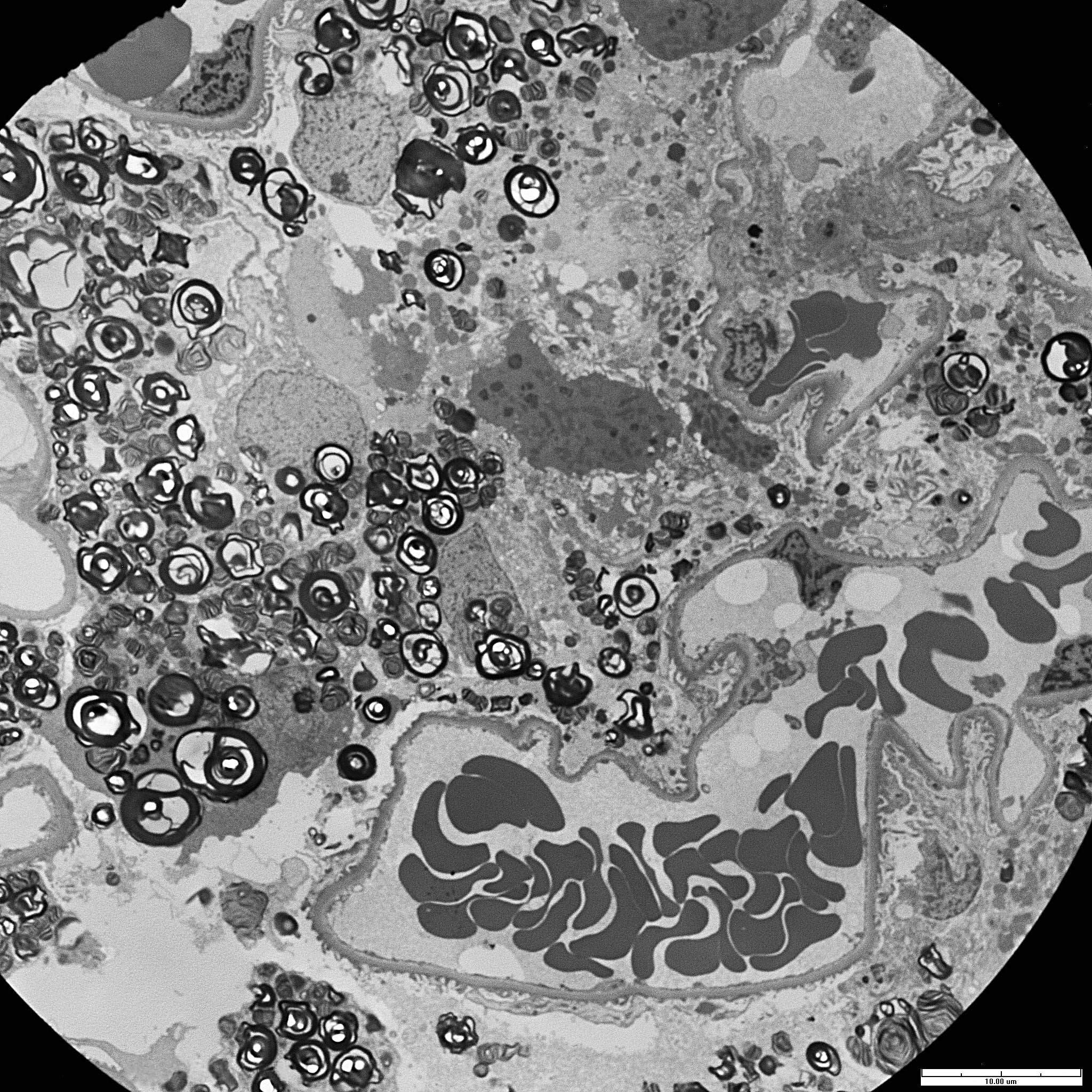 Electron microscopy1500X