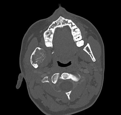 Lora_Gonzalez_Case_4_2023.jpg