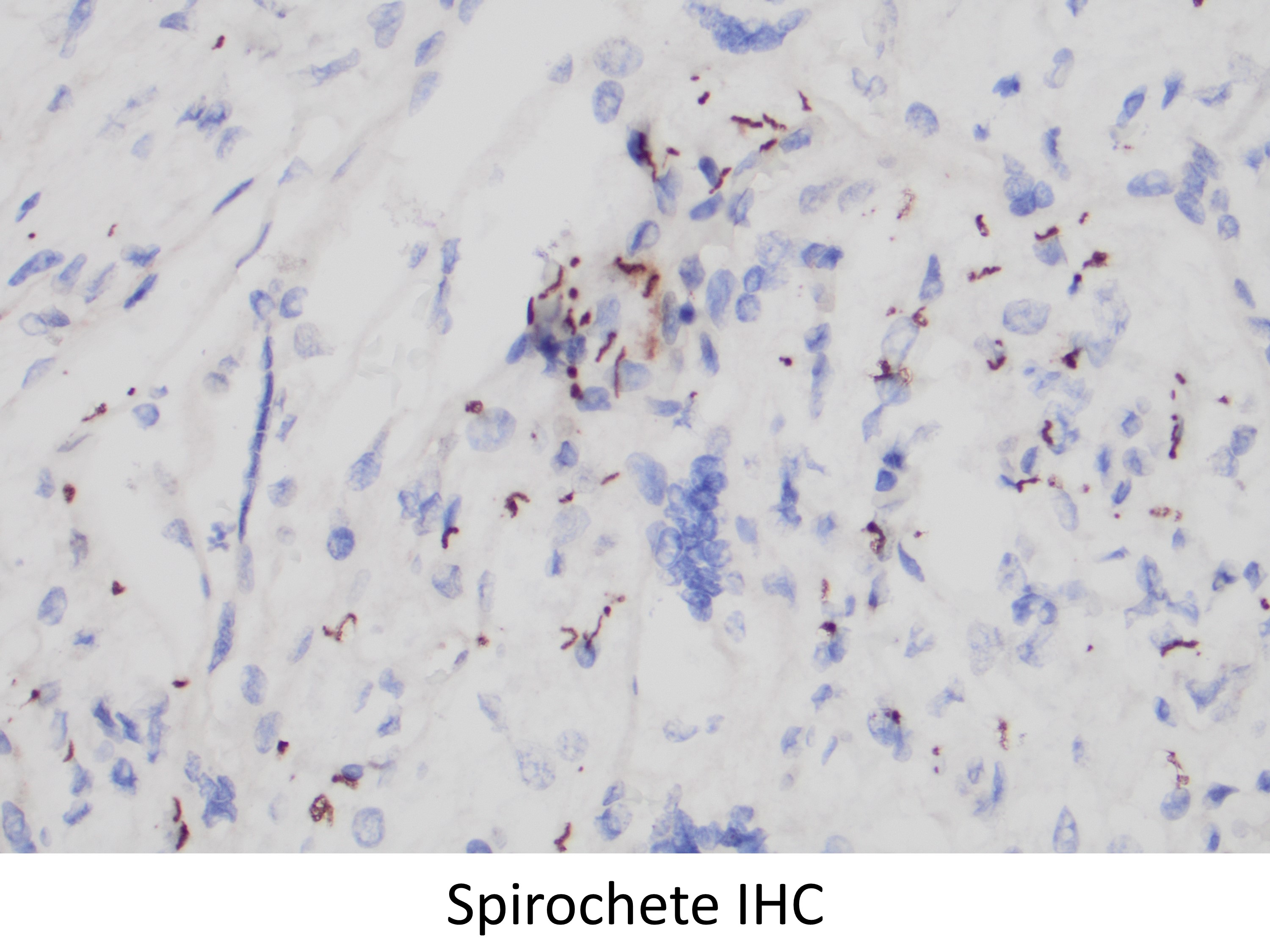 Spirochete IHC 40x