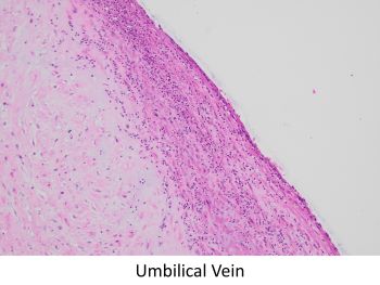 umbilical vein HE 20x