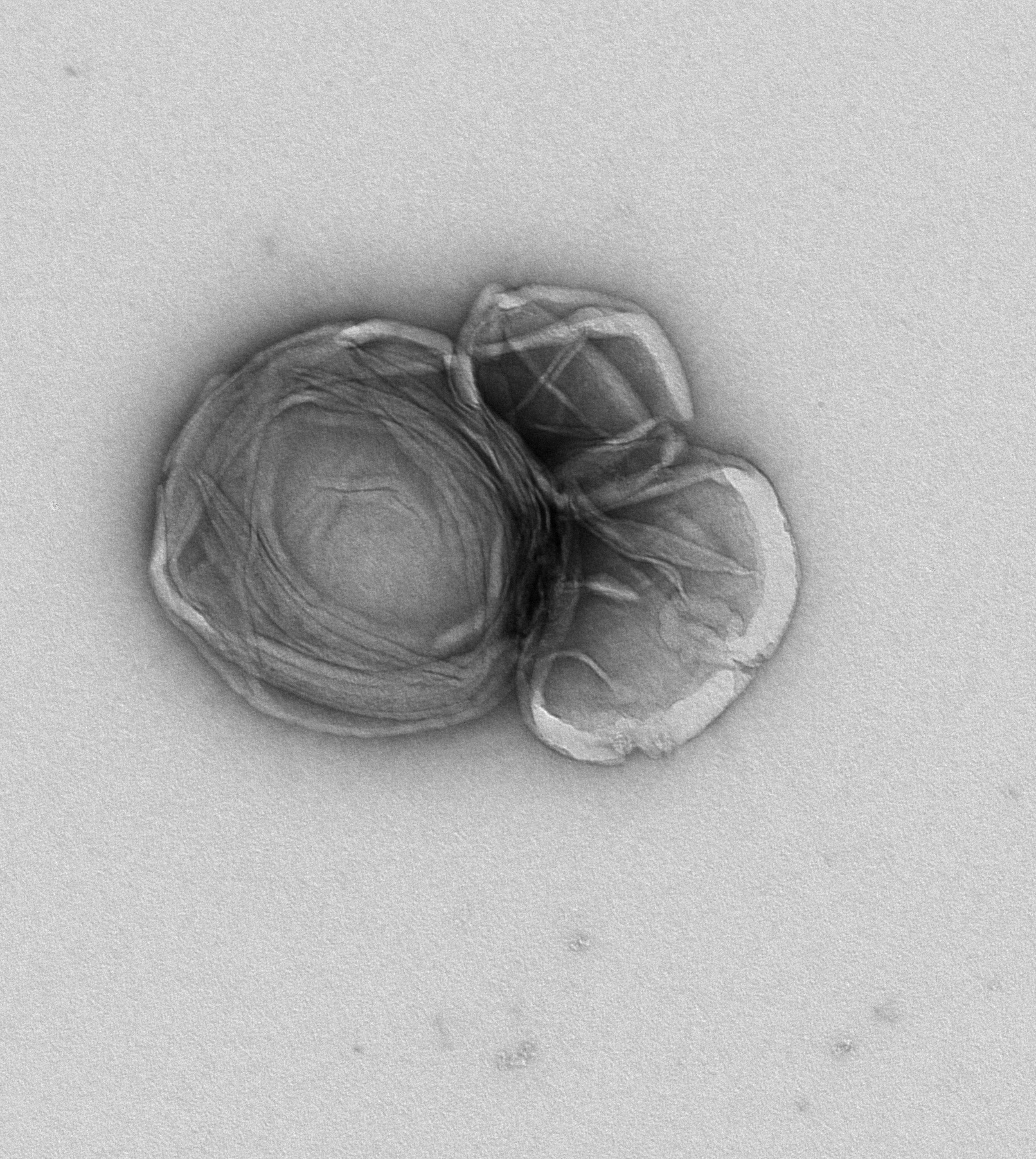 JD35 BALF Exosome 2 cropped 6