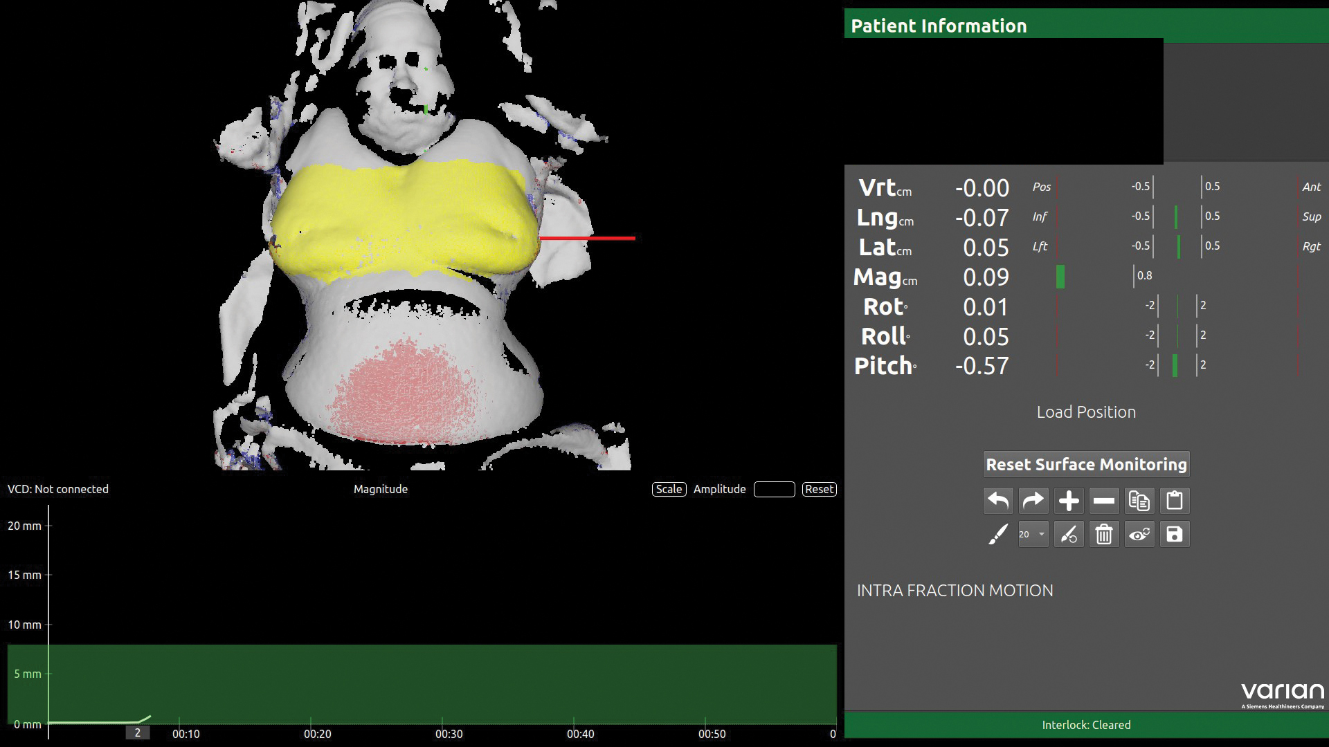 Breast Image 2 rgb