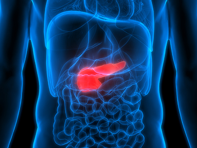 Pancreatic Cancer