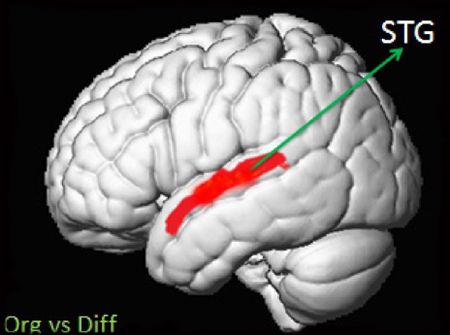 BrainJoomla