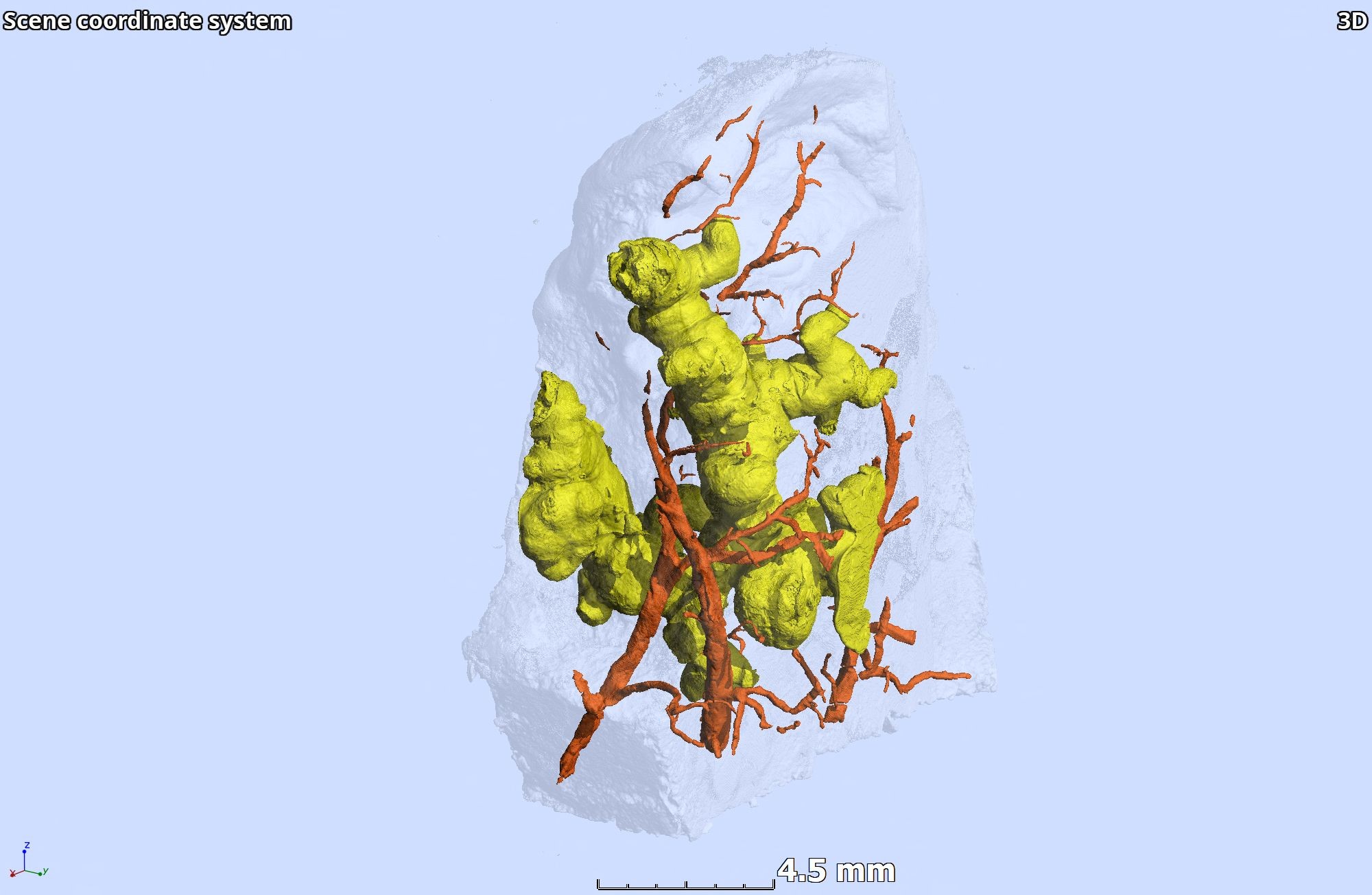 Granulomas and blood vessels Credit Africa Health Research Institute