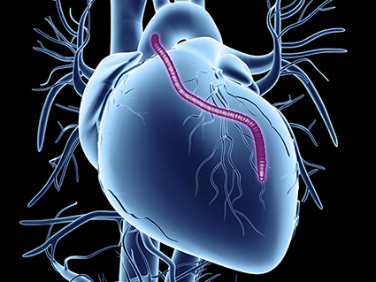 Heart bypass graft. Computer artwork of a heart that has had a blockage of the coronary arteries treated by coronary artery bypass graft (CABG) surgery. The coronary arteries are the small blood vessels seen running over the outer surface of the heart. They supply oxygenated blood to keep the heart muscle pumping, and a blockage can cause a fatal heart attack. The solution is to harvest arteries from elsewhere in the body and use them to bypass the blockage. One graft is seen running from the aorta, the main body artery, back to the coronary arteries.