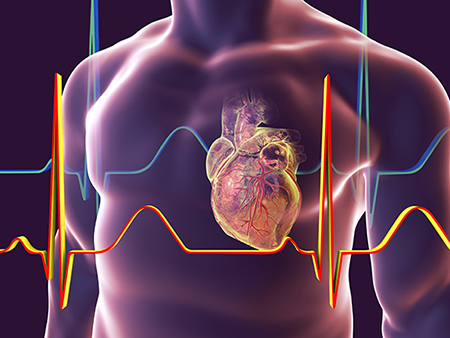 Heart with coronary vessels inside human body, computer illustration.