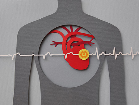 Paper craft illustration of human chest with heart and pacemaker.