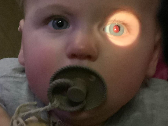 eye baby stream size