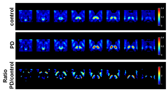 inside PET figure binding potential 003