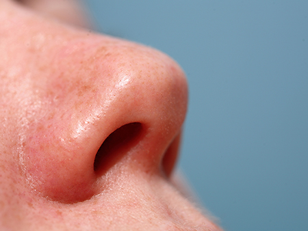 Close up of a female nose pointing upwards with a blue background