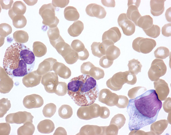 eosinophils