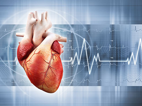 familial hypercholesterolemia