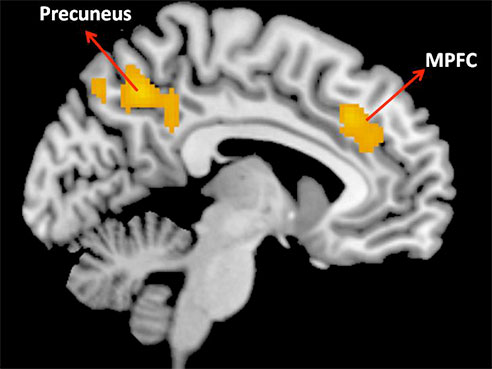 fmri 1