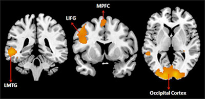 fmri 3