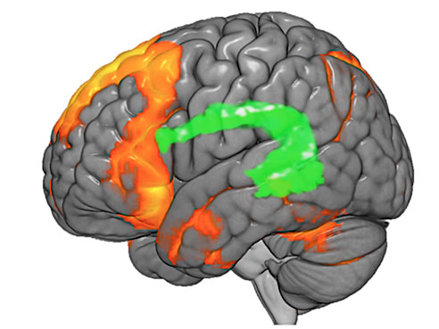 fmri brain