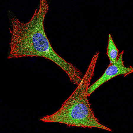 glioma cells