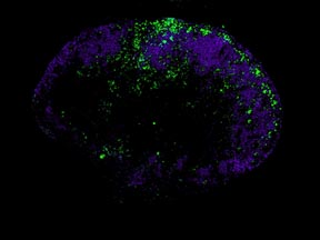 immunology_story