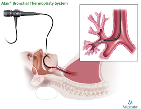 Human_side_view_and_Airway_device_site