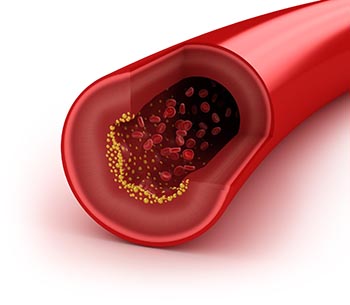 muntner_cholesterol_s