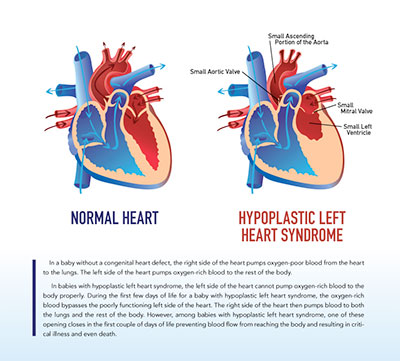 normal heart small