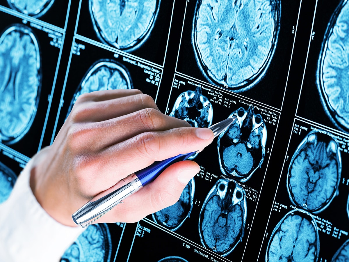 Hand pointing at brain scans on a screen.